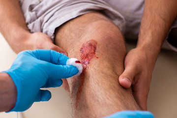 Leg injured man visiting old doctor in first aid concept