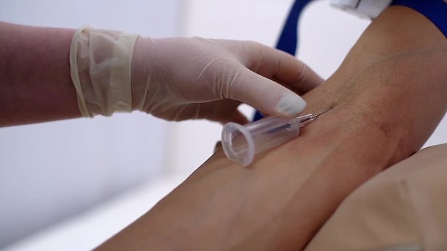 Close-up of hand of man giving blood for biochemical blood testing. Phlebotomist technician drawing blood for testing Coronavirus COVID-19 disease infestation. Shooting in slow motion.