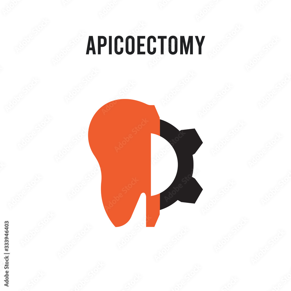 Aufkleber apicoectomy vector icon on white background. red and black colored apicoectomy icon. simple element 