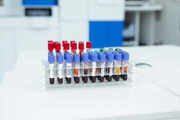 Coronavirus blood test concept. Analyzing blood sample in test tube for coronavirus test. Tube with blood for 2019-nCoV or COVID-19 test.
