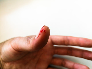 Bleeding human thumb closeup - scotch