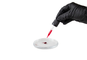 Blood test on a petri dish, a pipette with red liquid.