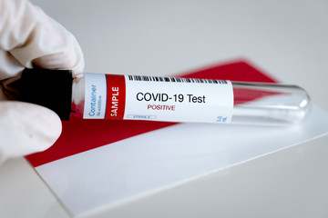 Obraz premium Testing for presence of coronavirus in Indonesia. Tube containing a swab sample that has tested positive for COVID-19. Indonesian flag in the background.