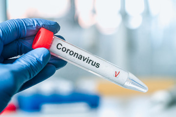 Obraz premium Coronavirus test. Hand in gloves holds a test tube with a corona virus test label on blurred laboratory in the background. COVID-19 or SARS-CoV-2 test concept.