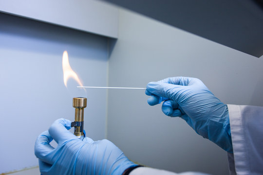 Eine Person h&auml;lt ein St&auml;bchen &uuml;ber eine Flamme eines Bunsenbrenners