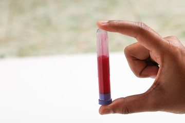 Coronavirus 2019-nCoV Blood Sample. New Epidemic Corona Virus.