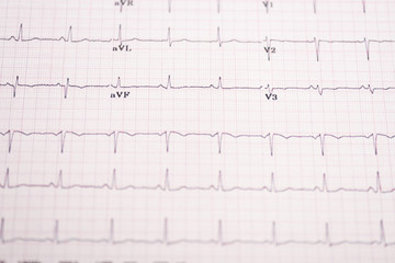 Naklejka premium Selective focus of electrocardiogram on paper
