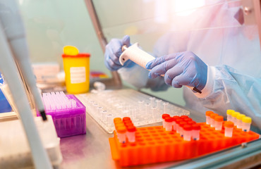 Research in laboratory. Professional laboratory assistant taking blood test for DNA research....