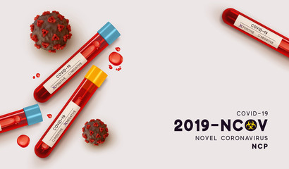 Blood tube for testing in laboratory on coronavirus SARS CoV-2. Blood test for viral disease Covid-19 NCP. Realistic 3d test tube, results sample for virus positive-negative. Vector illustration