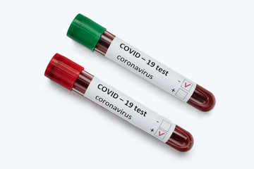Two laboratory test tubes with blood samples: positive and negative COVID-19 tests, isolated on white background. Coronavirus pandemic concept. Copy space