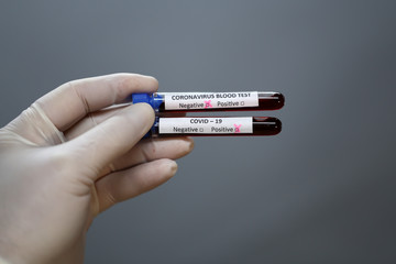 Coronavirus testing. A hand holds test tubes with coronavirus results.