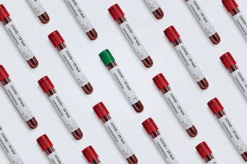 Closeup of laboratory test tubes with blood samples: many positive and one negative COVID 19 tests. Flat lay, top view, pattern, white background. Coronavirus outbreak concept