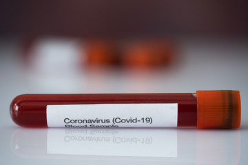 Coronavirus (Covid-19) test. Blood sample