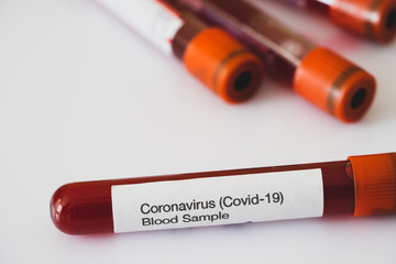 Coronavirus (Covid-19) test. Blood sample