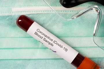 Coronavirus (Covid-19) test. Blood sample