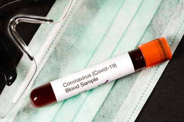 Coronavirus (Covid-19) test. Blood sample