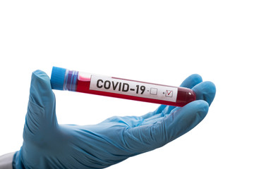 Obraz premium Microbiologist with a tube of biological sample contaminated by Coronavirus with label Covid-19