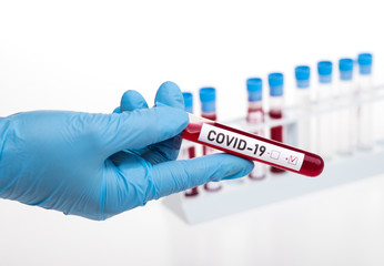 Obraz premium Microbiologist with a tube of biological sample contaminated by Coronavirus with label Covid-19
