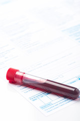 Blood Test Samples for Presence of Coronavirus (COVID-19) Tube Containing a Blood Sample from Patient