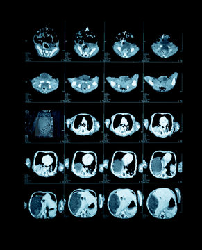 Magnetic resonance image (MRI) of the brain.