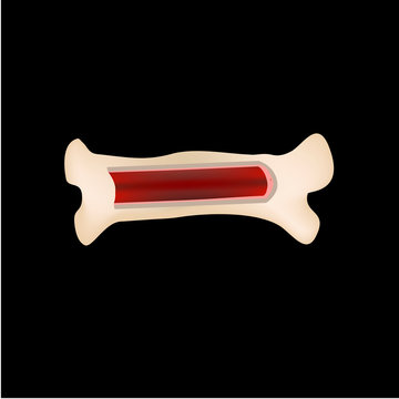 Bone Stem Cell. Bone Marrow. Blood Cells. Infographics. Vector Illustration On Isolated Background.