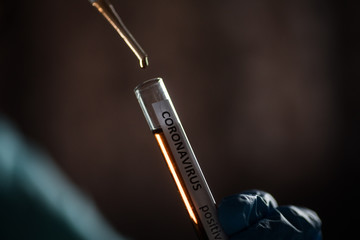 Doctor taking samples from coronavirus COVID-19 test tube