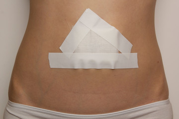 Young woman's belly after operation by laparoscopy in the hospital. The abdomen sealed with plaster...