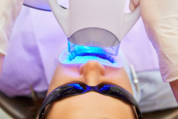 Blue LED light with teeth whitening at the dentist