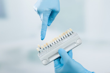 Close up of shade guide to check veneer of tooth crown in a dental laboratory for bleaching 