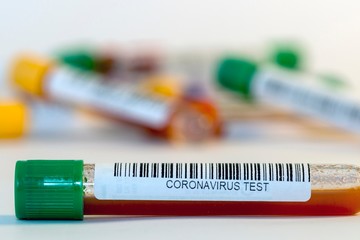 Blood test tubes for coronavirus. - 334231245