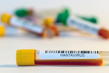 Blood test tubes for coronavirus. - 334231274