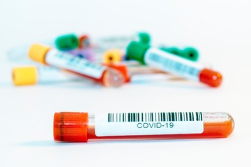 Blood test tubes for coronavirus. - 334231428