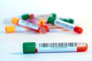 Blood test tubes for coronavirus. - 334231491