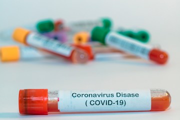 Blood test tubes for coronavirus. - 334231658