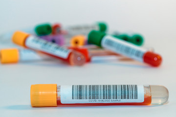 Blood test tubes for coronavirus. - 334231829