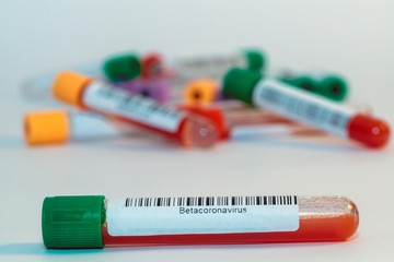 Blood test tubes for coronavirus. - 334231875