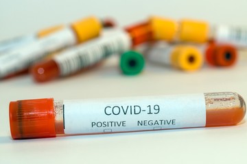 Blood test tubes for coronavirus. - 334232401