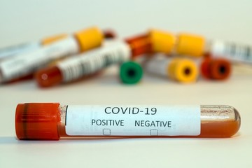 Blood test tubes for coronavirus. - 334232427