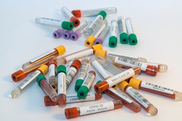 Blood test tubes for coronavirus. - 334232650