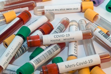 Blood test tubes for coronavirus. - 334232695