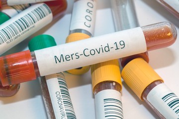 Blood test tubes for coronavirus. - 334232800