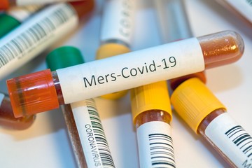 Blood test tubes for coronavirus. - 334232870
