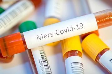 Blood test tubes for coronavirus. - 334232897