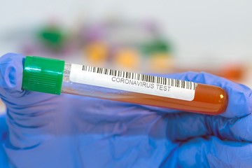 The attendant holds the blood test tube in his hand for corovirus. - 334233403