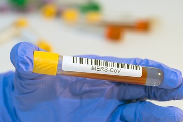 The attendant holds the blood test tube in his hand for corovirus.