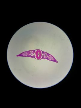 Planaria, L&auml;ngsschnitt 