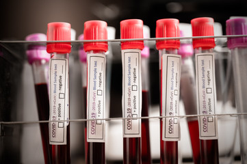 Blood sample test tube for COVID-19 test, novel coronavirus 2019 found in Wuhan, China