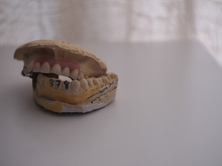 old Denture on the white table