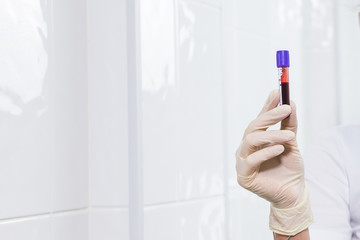 Covid-19, coronavirus, pandemic and viruses concept - woman holding blood in tests tubes close up, background with copy space.