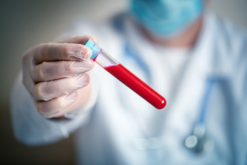 The epidemic of coronavirus. Hand of a doctor holding a bottle of blood sample.